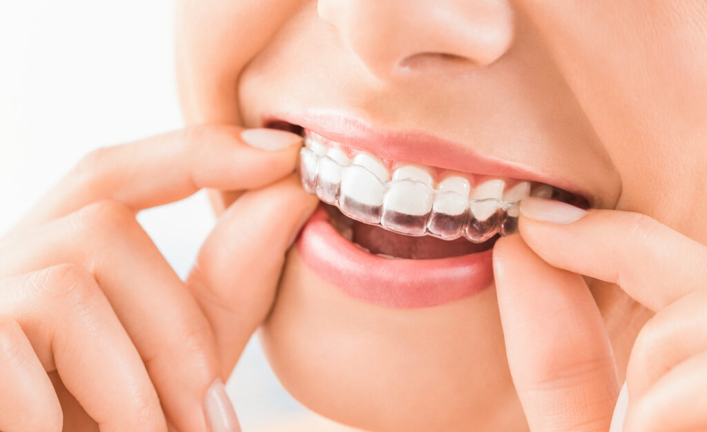 How Adult Orthodontics Can Improve More Than Just Your Smile