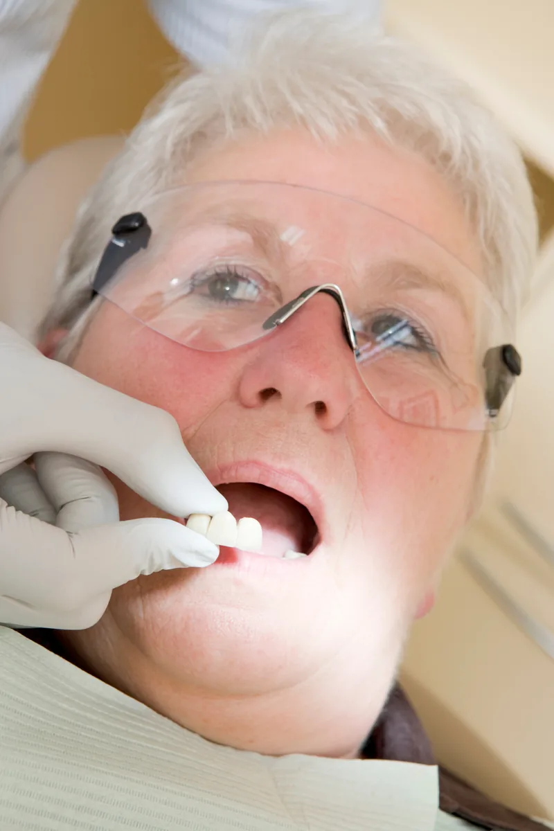 Dentist fitting a complete denture during a patient appointment