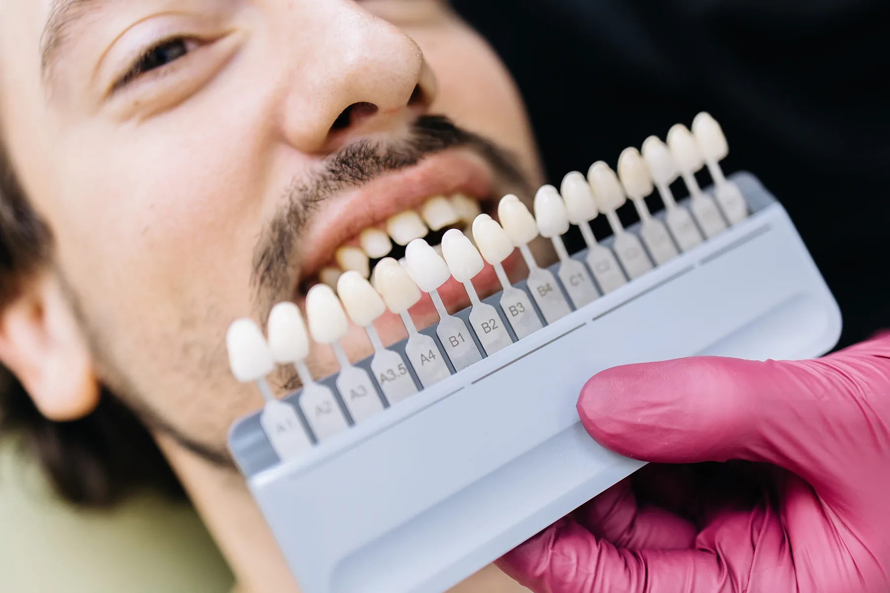 Dentist comparing tooth shades with a patient for smile design