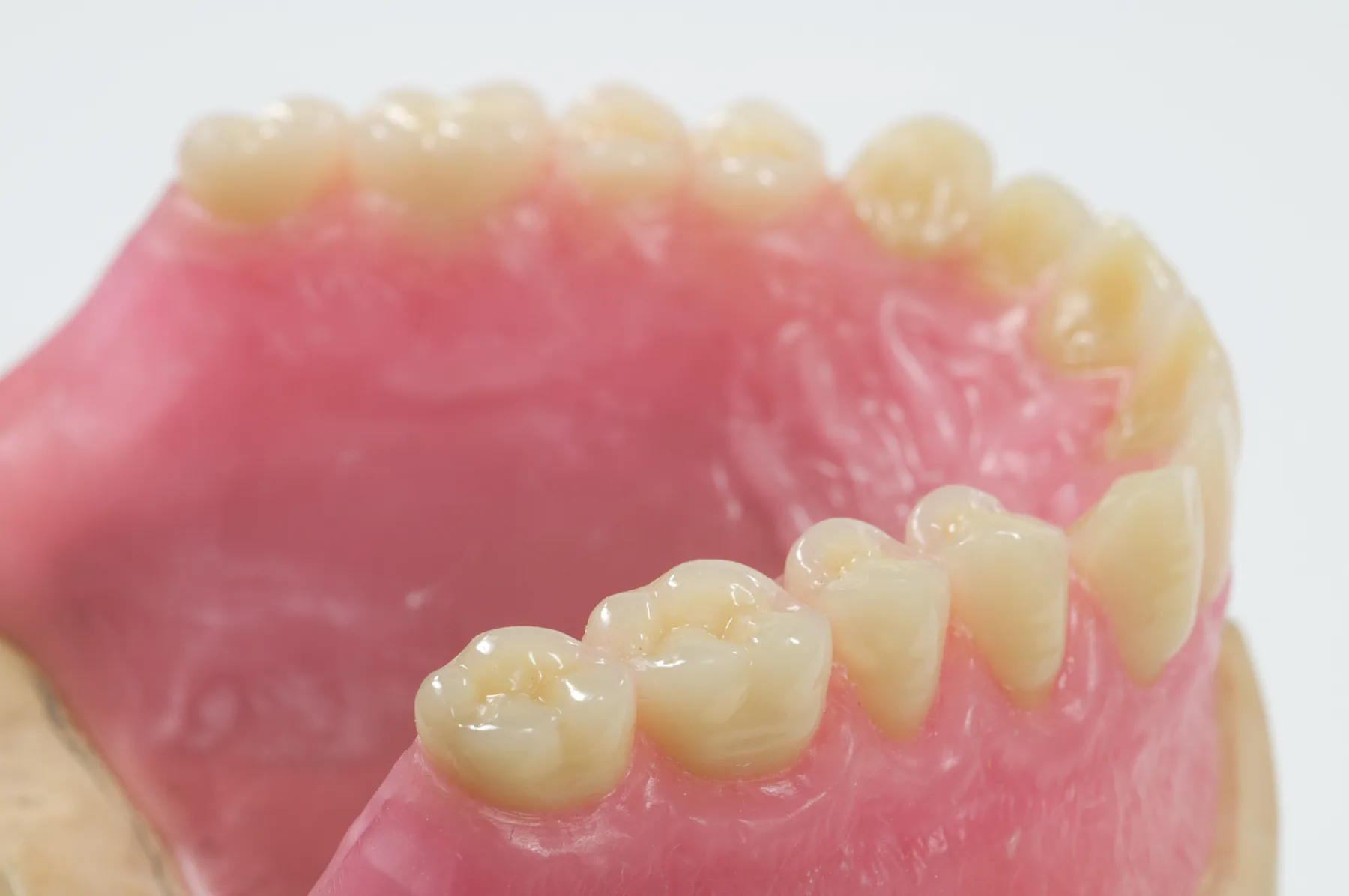 Custom upper denture arranged in wax during the denture fabrication process