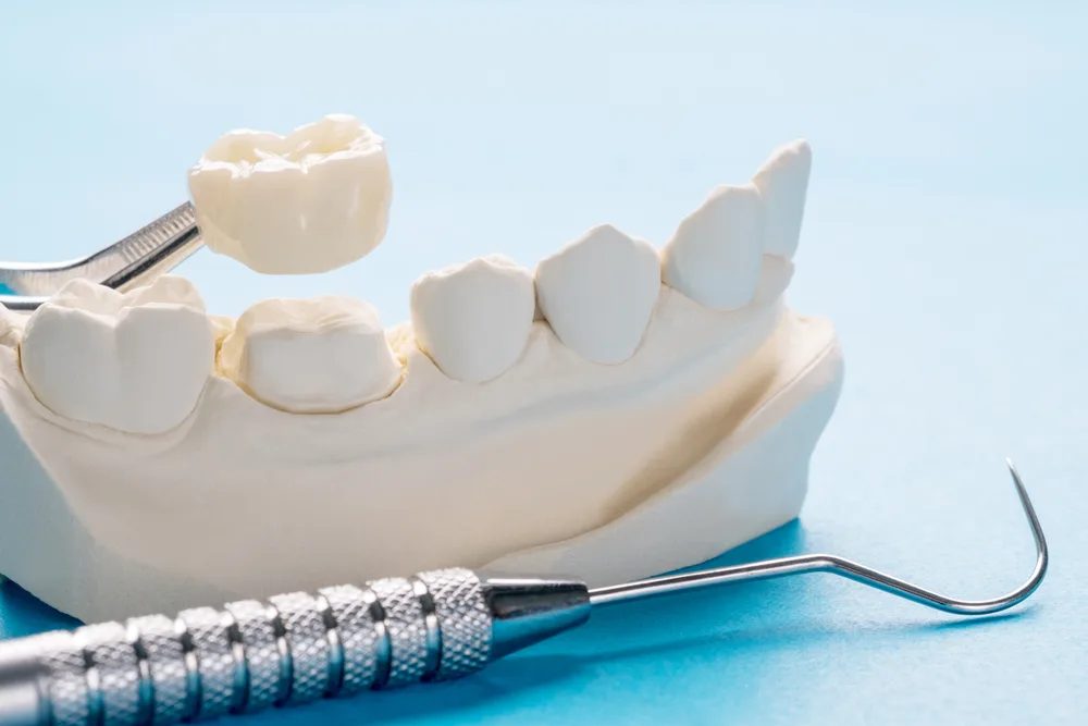 Dental crown restoration image from the original Troup Family Dental crown page
