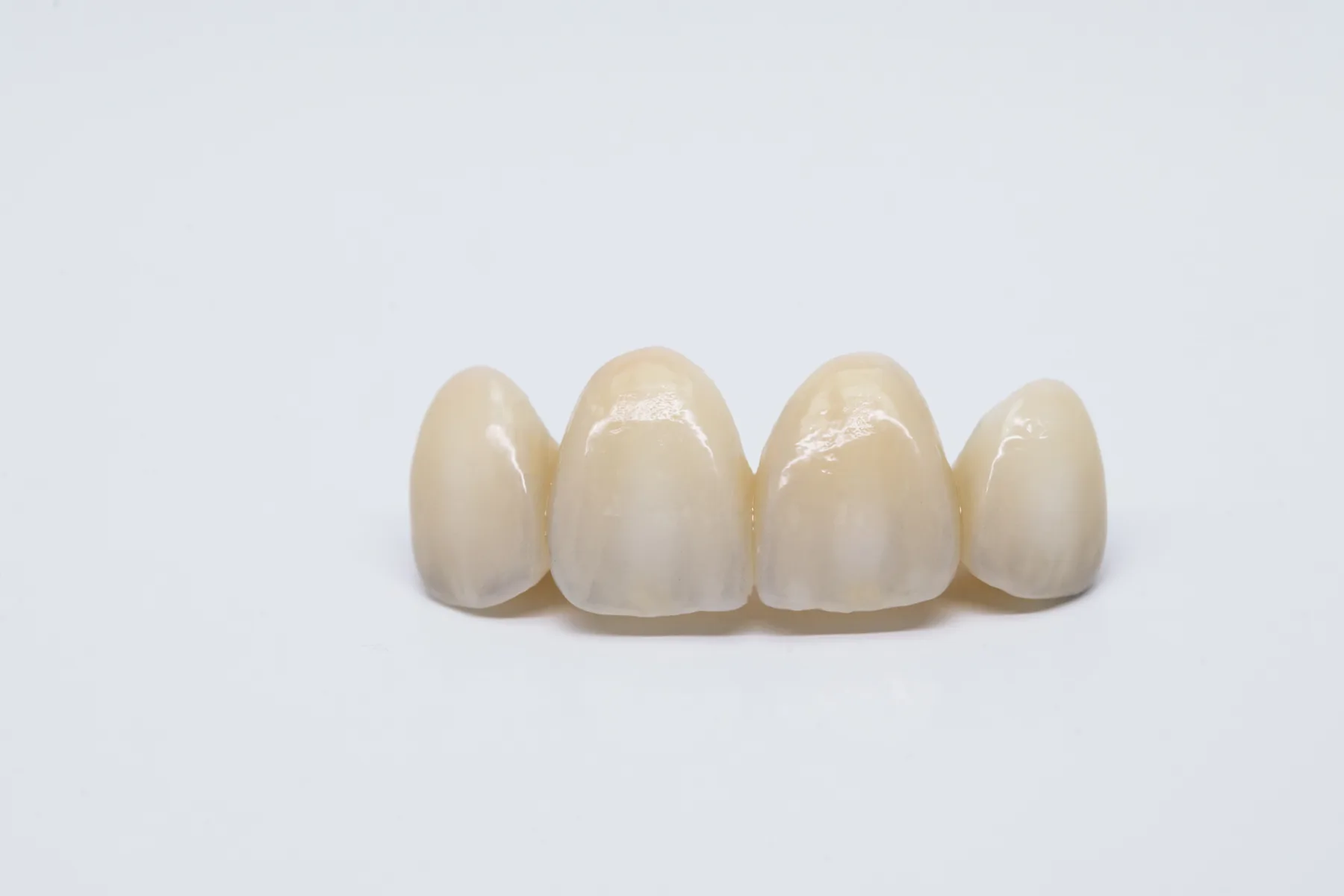 Metal-free ceramic dental bridge on a clean background