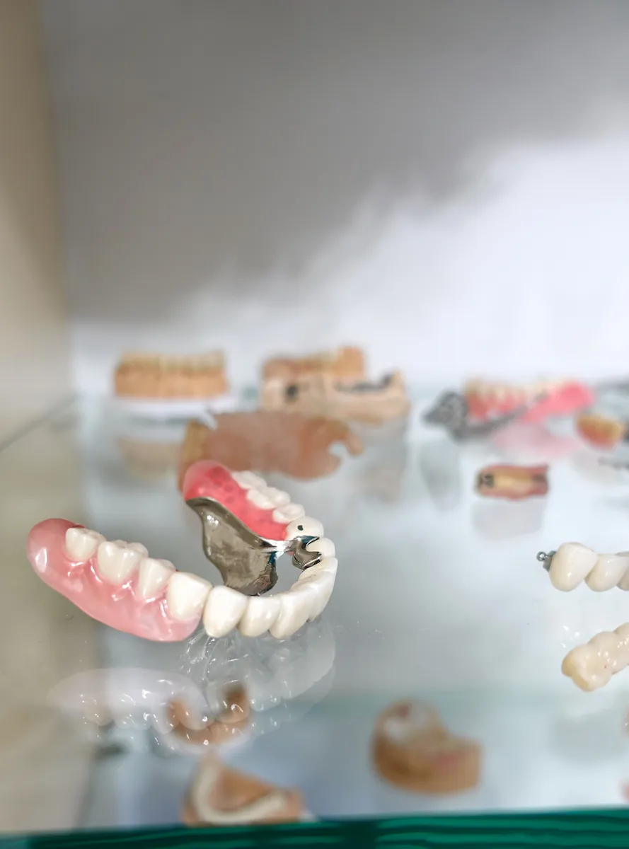 Porcelain dental crown restoration held by a clinician