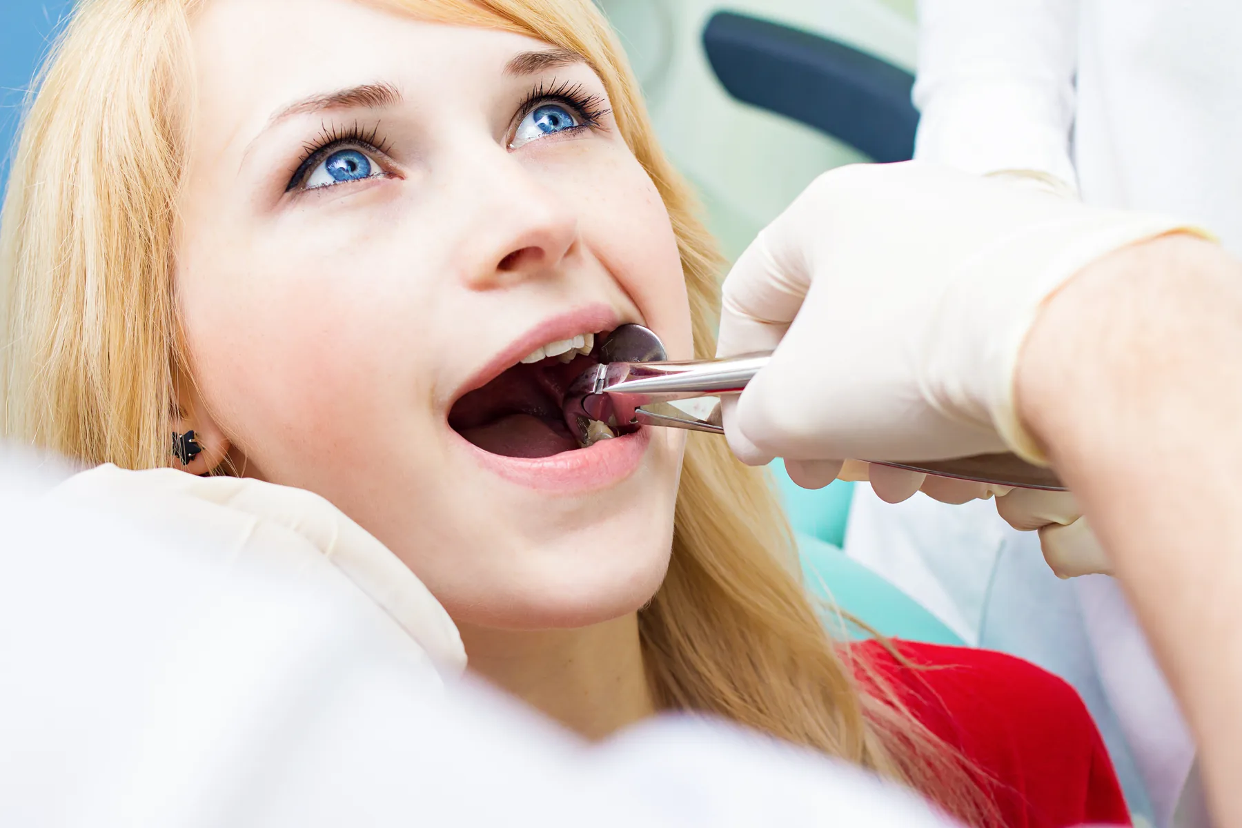 Dentist completing a tooth extraction procedure